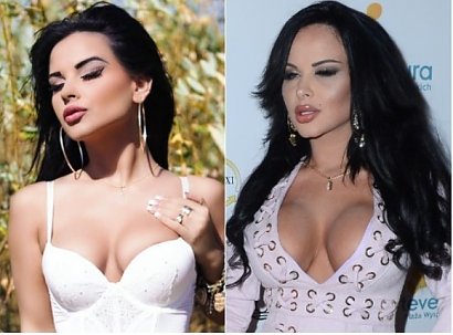 Esmeralda przed i po powiększeniu piersi