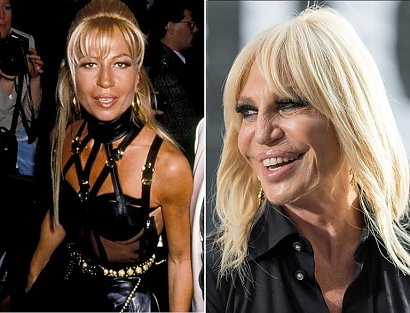 Kiedyś Donatella Versace wyglądała zupełnie inaczej. Przez 62 lata Włoszka przeszła kilka zmian wyglądu, wypełniła policzki, napełniła usta silikonem i powiększyła piersi. Cóż, jest jedną z najbardziej wpływowych kobiet w świecie mody - co oznacza, że może sobie pozwolić na wyglądanie tak, jak chce.