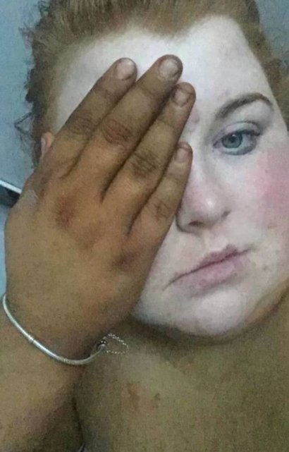 Twarz była biała, a ręce czarne. Kobieta zapomniała posmarować twarz samoopalaczem i zmyć produkt z dłoni... To jednak nie wszystko...